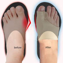 Charger l&#39;image dans la galerie, Correcteur orthopédique en gel pour hallux valgus
